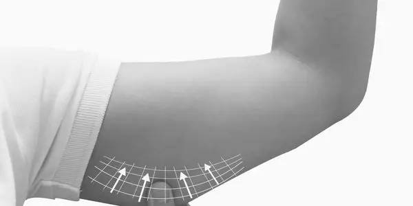 Sculpting the Upper Arms: A Practical Guide to Lipo Before You Commit